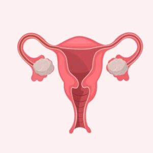 PCOS Mastery Science • Nutrition • Practice